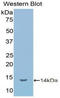 Interleukin 1 Receptor Type 1 antibody, LS-C294810, Lifespan Biosciences, Western Blot image 