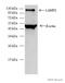 Lysosomal Associated Membrane Protein 2 antibody, ab25631, Abcam, Western Blot image 