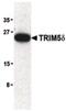 Tripartite Motif Containing 5 antibody, PA5-20048, Invitrogen Antibodies, Western Blot image 