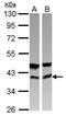 Calcium Binding Protein 39 antibody, GTX110628, GeneTex, Western Blot image 
