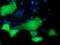 Protein Kinase D2 antibody, MA5-25231, Invitrogen Antibodies, Immunocytochemistry image 