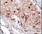 Sphingosine Kinase 1 antibody, PA5-14068, Invitrogen Antibodies, Immunohistochemistry frozen image 