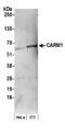 Coactivator Associated Arginine Methyltransferase 1 antibody, NB200-341, Novus Biologicals, Western Blot image 