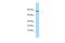 Trehalase antibody, PA5-45708, Invitrogen Antibodies, Western Blot image 