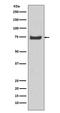 KIAA0417 antibody, M13632, Boster Biological Technology, Western Blot image 