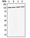 ABL Proto-Oncogene 2, Non-Receptor Tyrosine Kinase antibody, GTX54914, GeneTex, Western Blot image 