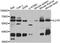 Interleukin 21 Receptor antibody, A7468, ABclonal Technology, Western Blot image 