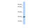 Zinc Finger CCHC-Type Containing 24 antibody, 27-054, ProSci, Enzyme Linked Immunosorbent Assay image 