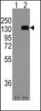 Cadherin 1 antibody, PA5-11549, Invitrogen Antibodies, Western Blot image 