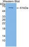 Transforming Growth Factor Beta Receptor 3 antibody, LS-C314899, Lifespan Biosciences, Western Blot image 