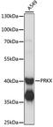 Protein Kinase X-Linked antibody, LS-C750275, Lifespan Biosciences, Western Blot image 