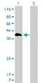 Homeobox A11 antibody, H00003207-M01, Novus Biologicals, Western Blot image 