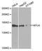 Myosin Light Chain Kinase antibody, GTX64416, GeneTex, Western Blot image 