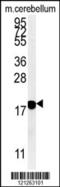 Synuclein Beta antibody, 62-068, ProSci, Western Blot image 