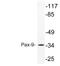 Paired box protein Pax-9 antibody, LS-C199962, Lifespan Biosciences, Western Blot image 