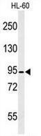 Calpain 3 antibody, AP50723PU-N, Origene, Western Blot image 