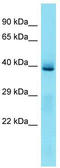 Krueppel-like factor 3 antibody, TA345206, Origene, Western Blot image 