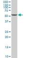 Cytochrome P450 Family 11 Subfamily A Member 1 antibody, H00001583-D01P, Novus Biologicals, Western Blot image 