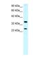 Asialoglycoprotein Receptor 2 antibody, NBP1-52958, Novus Biologicals, Western Blot image 