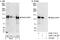 RAB3 GTPase Activating Protein Catalytic Subunit 1 antibody, A302-114A, Bethyl Labs, Western Blot image 