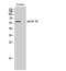 Cholinergic Receptor Muscarinic 5 antibody, STJ93979, St John