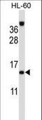 Endosomal adaptor protein p14 antibody, LS-C162674, Lifespan Biosciences, Western Blot image 