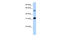 3-Oxoacid CoA-Transferase 1 antibody, 30-414, ProSci, Enzyme Linked Immunosorbent Assay image 