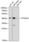 ST3 Beta-Galactoside Alpha-2,3-Sialyltransferase 4 antibody, 22-118, ProSci, Western Blot image 