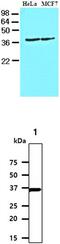 Casein Kinase 1 Alpha 1 antibody, MBS200165, MyBioSource, Western Blot image 