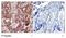 Nuclear Factor Kappa B Subunit 1 antibody, NB100-82069, Novus Biologicals, Immunohistochemistry paraffin image 