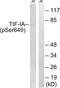 RNA polymerase I-specific transcription initiation factor RRN3 antibody, LS-C199654, Lifespan Biosciences, Western Blot image 