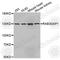 RAB3 GTPase Activating Protein Catalytic Subunit 1 antibody, A3387, ABclonal Technology, Western Blot image 