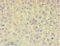 Actin Filament Associated Protein 1 antibody, LS-C378493, Lifespan Biosciences, Immunohistochemistry paraffin image 