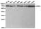 Checkpoint Kinase 2 antibody, TA327296, Origene, Western Blot image 