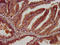 Olfactomedin 4 antibody, LS-C673164, Lifespan Biosciences, Immunohistochemistry paraffin image 