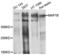 Microtubule Associated Protein 1B antibody, LS-C335324, Lifespan Biosciences, Western Blot image 