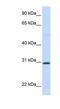 Stanniocalcin 1 antibody, NBP1-59310, Novus Biologicals, Western Blot image 