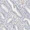 Serine/Threonine Kinase 31 antibody, HPA023194, Atlas Antibodies, Immunohistochemistry frozen image 