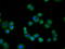 cAMP-specific 3 ,5 -cyclic phosphodiesterase 4A antibody, GTX83922, GeneTex, Immunocytochemistry image 