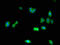 Cyclin Dependent Kinase 2 antibody, A62242-100, Epigentek, Immunofluorescence image 