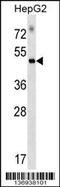 Rap Guanine Nucleotide Exchange Factor 5 antibody, 58-923, ProSci, Western Blot image 