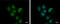 ADK antibody, GTX101372, GeneTex, Immunofluorescence image 