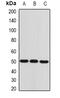 Alpha-Methylacyl-CoA Racemase antibody, abx225029, Abbexa, Western Blot image 