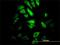 Proteasome Subunit Beta 10 antibody, H00005699-M01, Novus Biologicals, Immunofluorescence image 