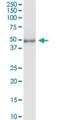 Tubulin Delta 1 antibody, H00051174-D01P, Novus Biologicals, Western Blot image 