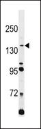L1 Cell Adhesion Molecule antibody, OAAB11621, Aviva Systems Biology, Western Blot image 