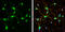 Glutamate Metabotropic Receptor 5 antibody, GTX133288, GeneTex, Immunocytochemistry image 