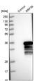 Ribosomal RNA Processing 36 antibody, PA5-56291, Invitrogen Antibodies, Western Blot image 