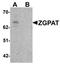 Zinc Finger CCCH-Type And G-Patch Domain Containing antibody, orb75699, Biorbyt, Western Blot image 