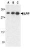 STE20 Related Adaptor Beta antibody, LS-C343, Lifespan Biosciences, Western Blot image 